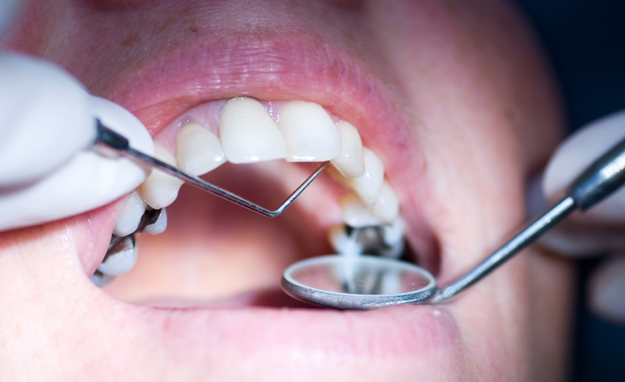 The Influence Of Meals For Oral And Dental Health