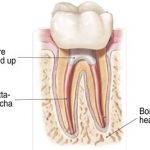 Root Canal Treatment