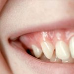 Healthy Gums