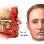 Facial Nerve