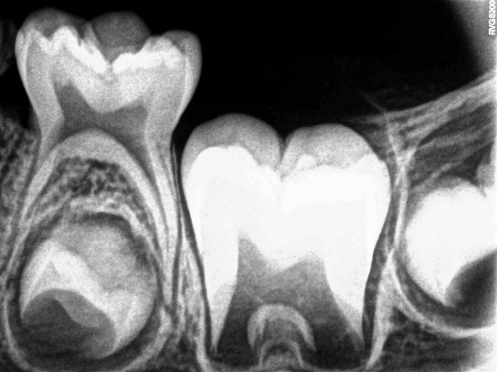 clinical developing dentition