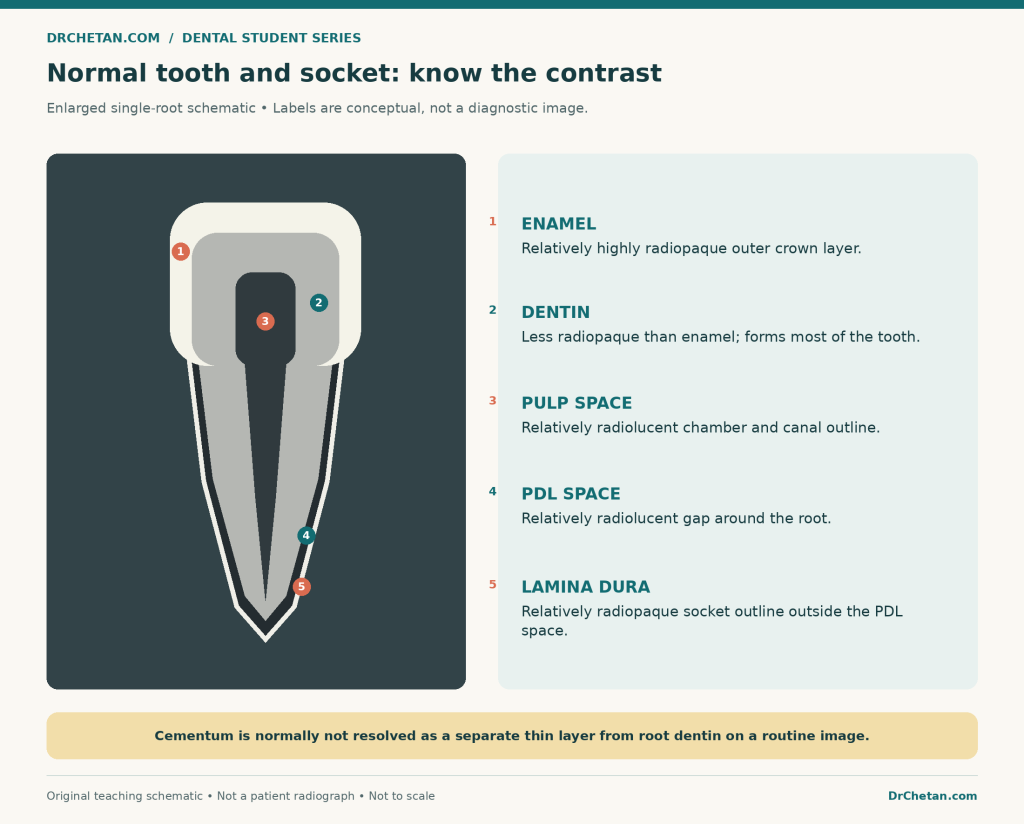iopa normal tooth supporting structures